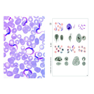 LIEDER Microscopische preparaten parasieten, 6 preparaten