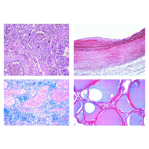 LIEDER Pathologische histologie van de mens, kleine serie (50 preparaten)