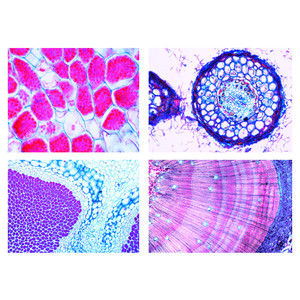 LIEDER Agricultura y silvicultura, parte III: parásitos animales, simbiosis y microbios (24 prep.)