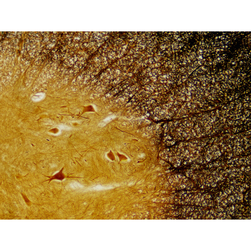 Bresser Duurpreparaten (histologie, mens) in houten doos (30)