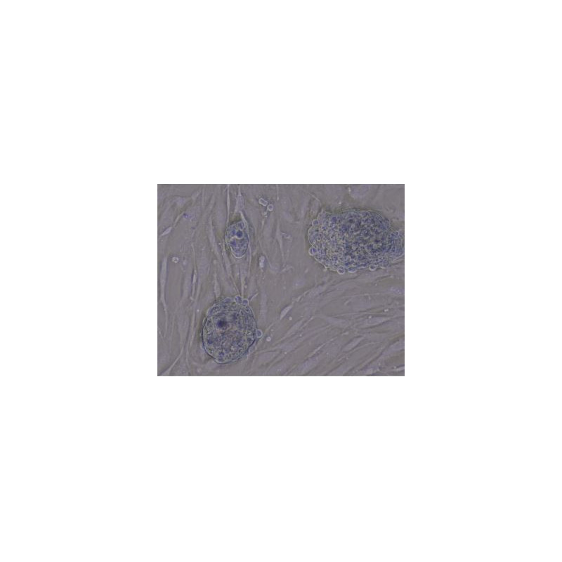 Evident Olympus Microscopio invertito CKX53, trinoculare, 100x, 200x, 400x, IPC/IVC tavolino x/y