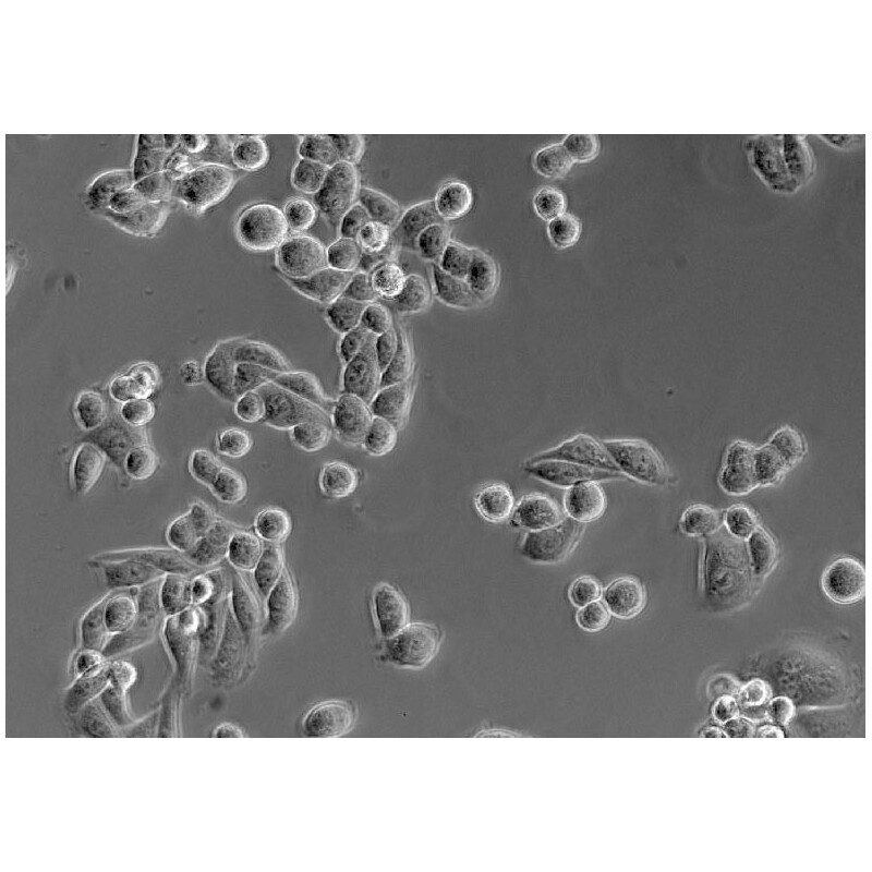 yeast cells 400x