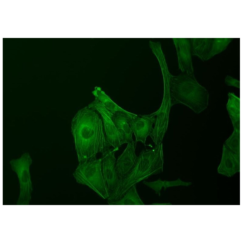 ZEISS Microscopio invertido Primovert trino PH1, 40x-400x